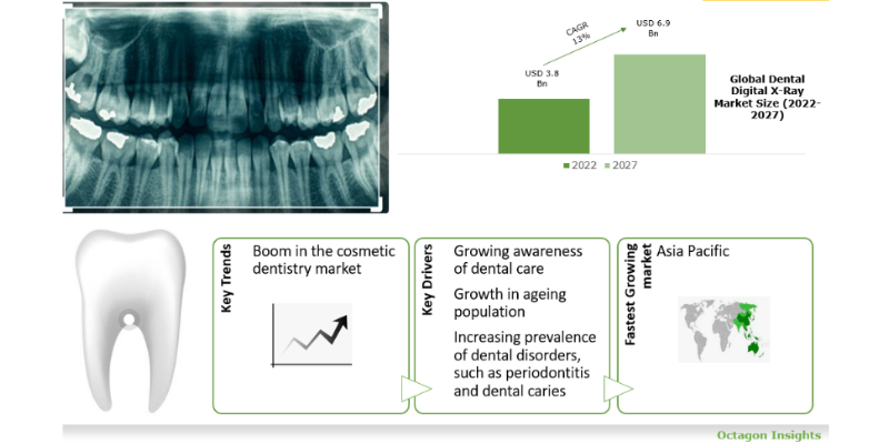 Global Dental Digital X-ray Market – Forecast to 2027
